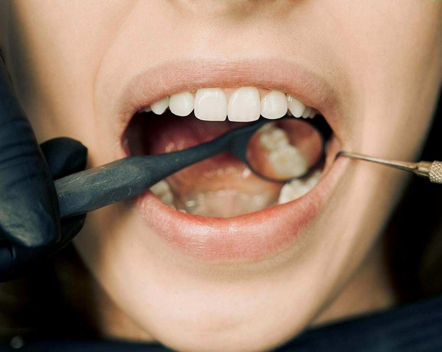 Close-up of a dental examination with modern equipment, showcasing oral hygiene maintenance.