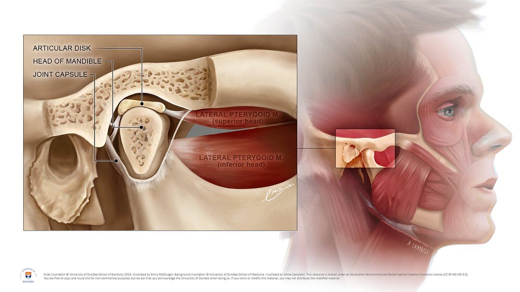 Temporomandibular Joint (tmj) By Emily Mcdougall And Annie Campbell